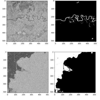 图像分割之U-Net家族，包含了多种先进的 U-Net模型及其变种
