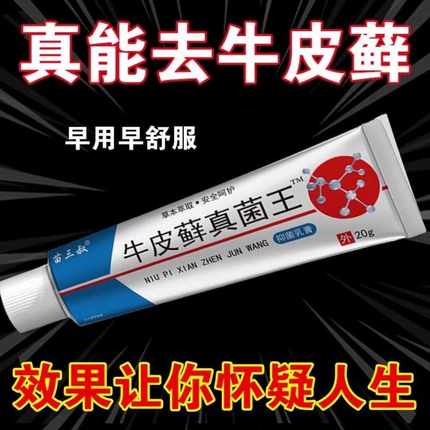 股藓大腿内侧根皮肤瘙痒真菌感染牛皮癣银屑药体股癣去湿疹止痒膏