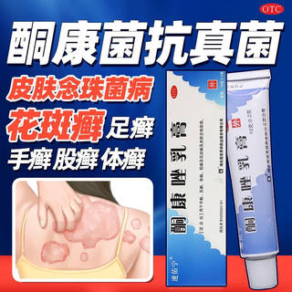 酮康唑乳膏正品酮康唑软膏外用大腿内侧真菌感染脚气专用药止痒DT