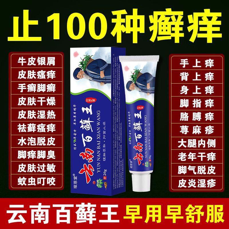 云南百癣王牛皮癣手足癣皮肤瘙痒皮炎湿疹止痒王草本抑菌乳膏止痒