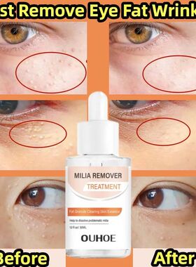 Rápido Colágeno Olho Fat Granulo Soro, Partícula anti-rug