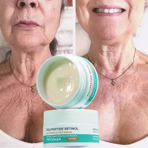 Retinol Wrinkle Remover Face Cream Firming Lifting Anti Agin