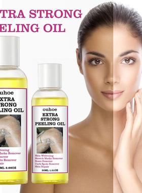 Aceite Peeling amarillo Extra fuerte, blanqueador, aclara el
