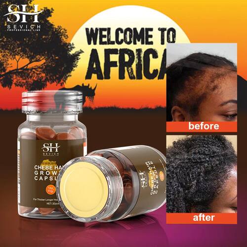 Anti-Hair Capsule Soro, óleo de crescimento rápido do cabe