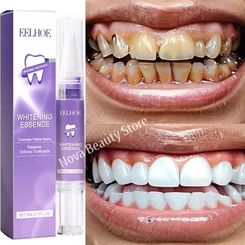 Magical Teeth Whitening Pen Effectively Removes Dental Plaqu