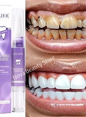Magical Teeth Whitening Pen Effectively Removes Dental Plaqu