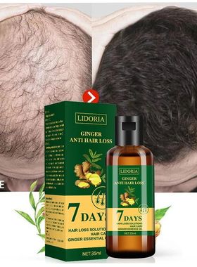 Gengibre crescimento do cabelo óleo essencial natural anti