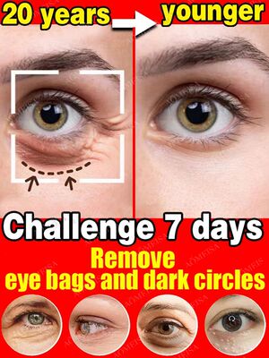 Anti-rugas creme para os olhos, remover sacos oculares, part