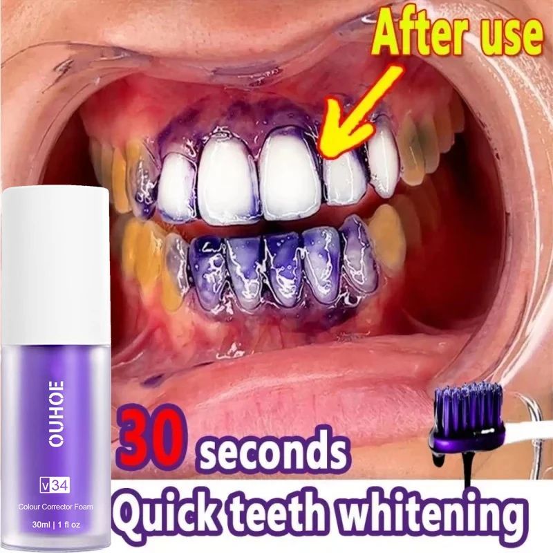 V34 Dentes Whitening Soro Creme Dental, Remover manchas de p