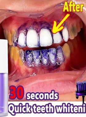 V34 Dentes Whitening Soro Creme Dental, Remover manchas de p