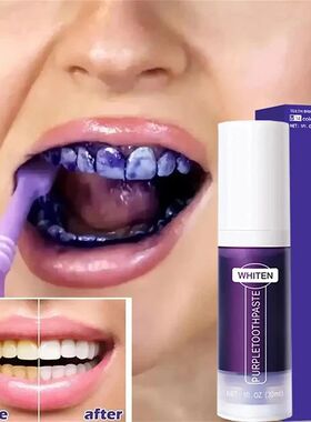 Creme dental para clareamento dos dentes, 5d, tiras de branq