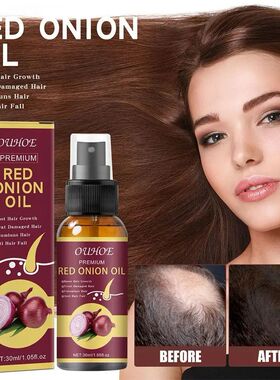 OUHOE Extrato de spray de óleo essencial de cebola vermelha