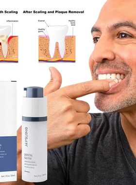 Gel blanqueador de dientes de 30ml, higiene bucal, pasta de