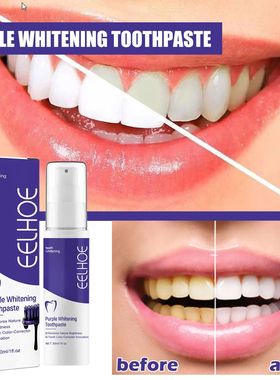 Dentífrico Clareamento Avan?ado Dentes, Oral Care, Tratamen