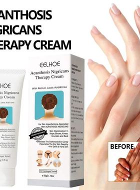 Creme De Lo??o Corporal Clareador, Creme De Pele De Melanina