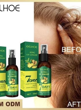 óleo essencial de crescimento rápido e eficaz do cabelo, g