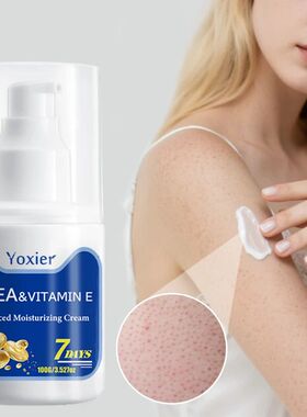 Urea Curing Keratosis Pilaris Cream Chicken Skin Repair Crea