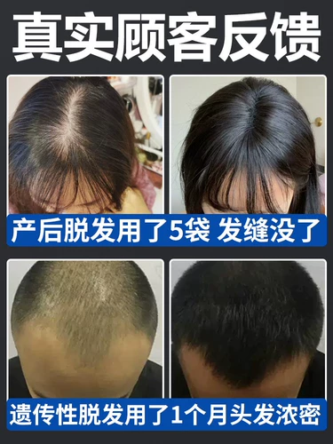 Shangguan Miao Шампунь для сильных и развитых волос с экстрактом растений, укрепляющий волосы для мужчин и женщин, контроль жирности и пушистость 8