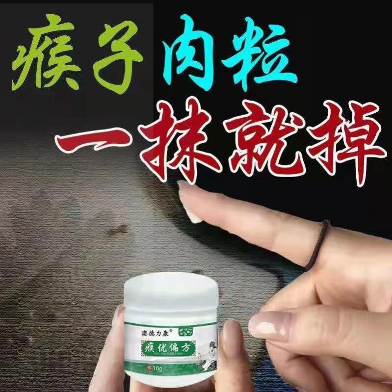 正宗偏方瘊子治鸡眼跖疣膏肉刺甲周疣趾疣寻常疣刺猴子
