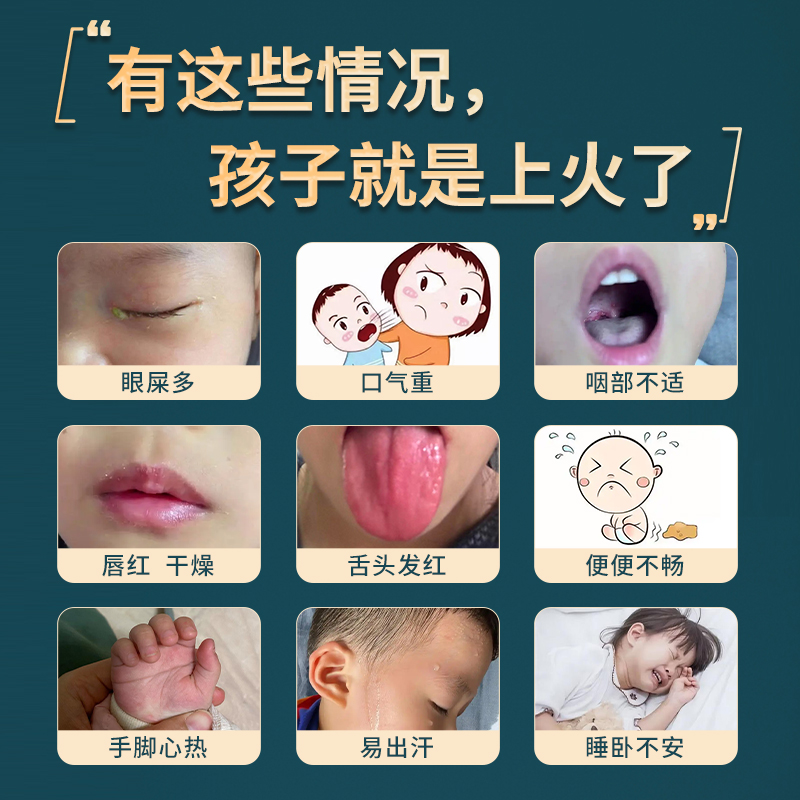 清上火贴热足贴婴儿积食内热