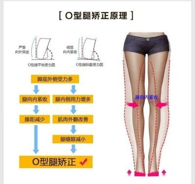 幼儿矫正鞋垫多少钱 幼儿矫正鞋垫优惠券免费领取 有条鱼