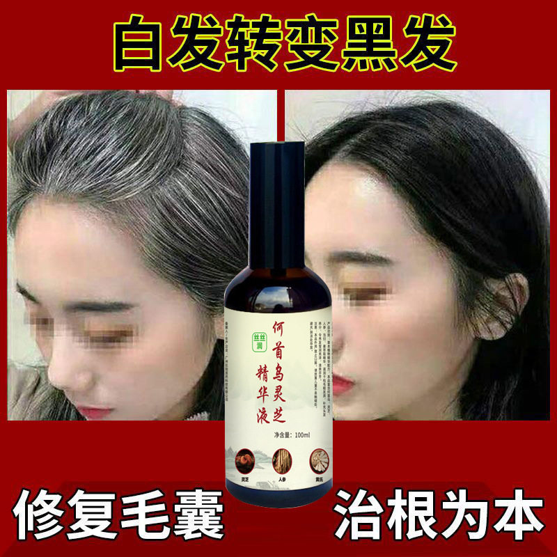 正品乔芙丽何首乌黑灵芝护发精油喷雾植物草本乌发液根部解决白发