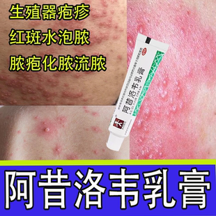阿昔洛韦乳膏10g生殖器单纯疱疹病毒红斑水泡脓疱化脓流脓软药膏