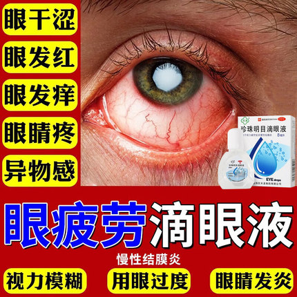 苏春珍珠明目滴眼液8ml结膜炎眼药水缓解眼视力疲劳清热泻火护眼