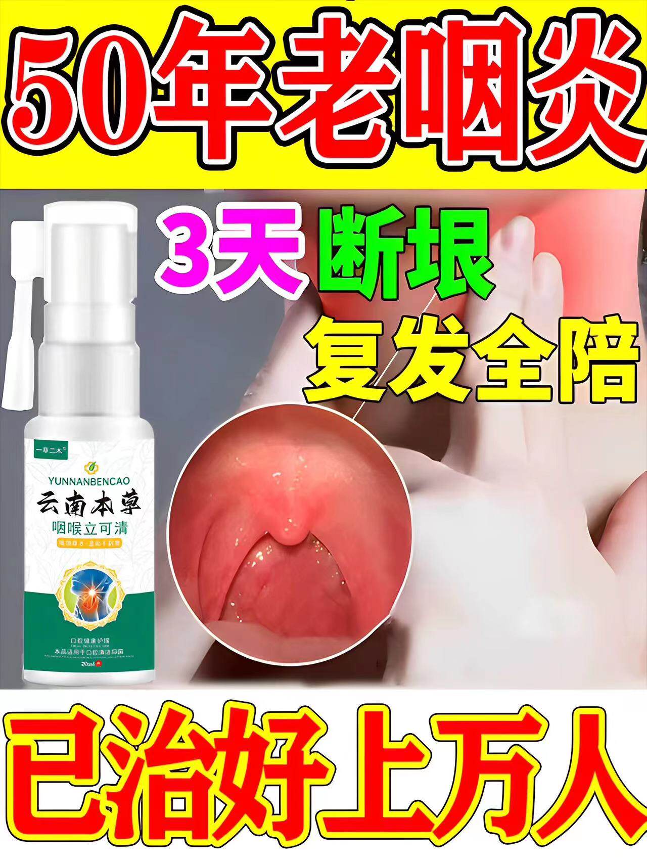 治疗咽炎慢性咽炎除根咽喉炎喉咙有痰异物感咳嗽喷雾特药专用贴