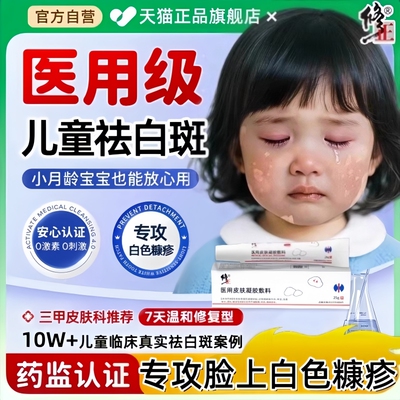 白色糠疹药膏儿童脸上长白斑