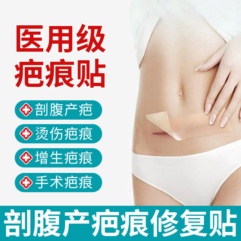剖腹产疤痕贴医用去修复增生凸起除剖宫产术后手术缝针隐形硅凝胶