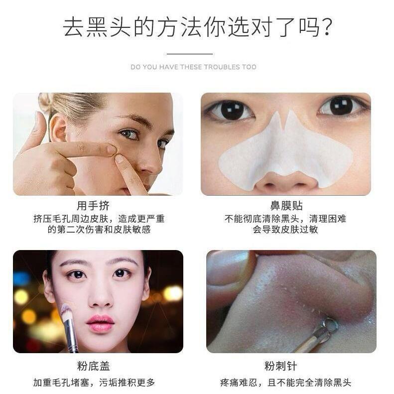 吸痘痘粉刺神器大吸力吸毛垃圾器 吸脸神部逗豆豆尘黑other头机孔