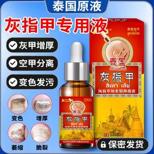 美浮特官方旗舰店灰指甲套盒益甲贝净卫灵菲甲嘉皮肤抗菌液灰指甲