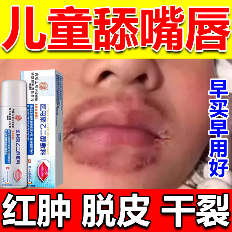 舌头舔嘴唇炎润唇膏儿童嘴唇防干裂脱皮医用剥脱性口角炎药监备案,医疗器械,医用乳膏（器械）,淘宝优惠券,粉丝福利购,淘宝优惠卷