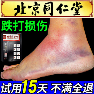 伤筋动骨膏药跌打损伤外用活血化瘀韧带拉伤疼脚踝扭伤专用膏药贴