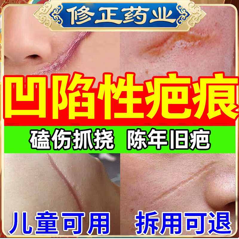 医用祛疤膏疤痕增生凝胶正品