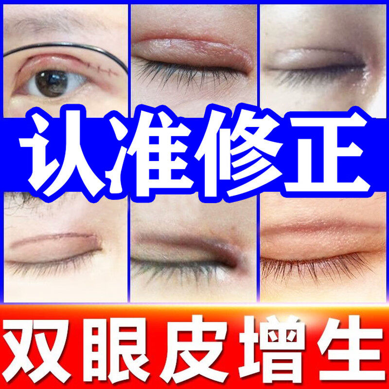 双眼皮术后祛疤膏防增生修复除疤