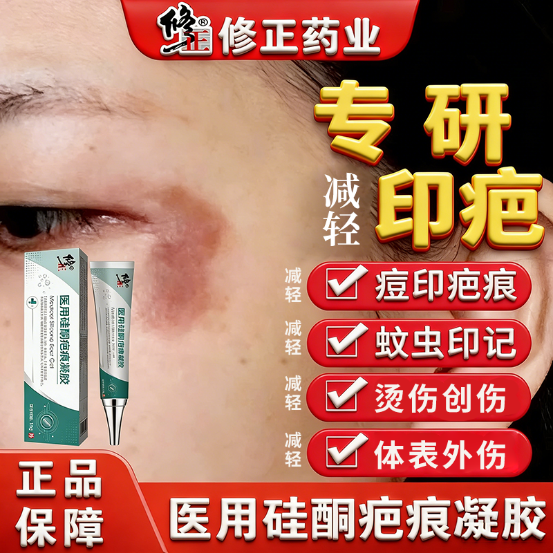 医用祛疤膏疤痕增生凝胶正品