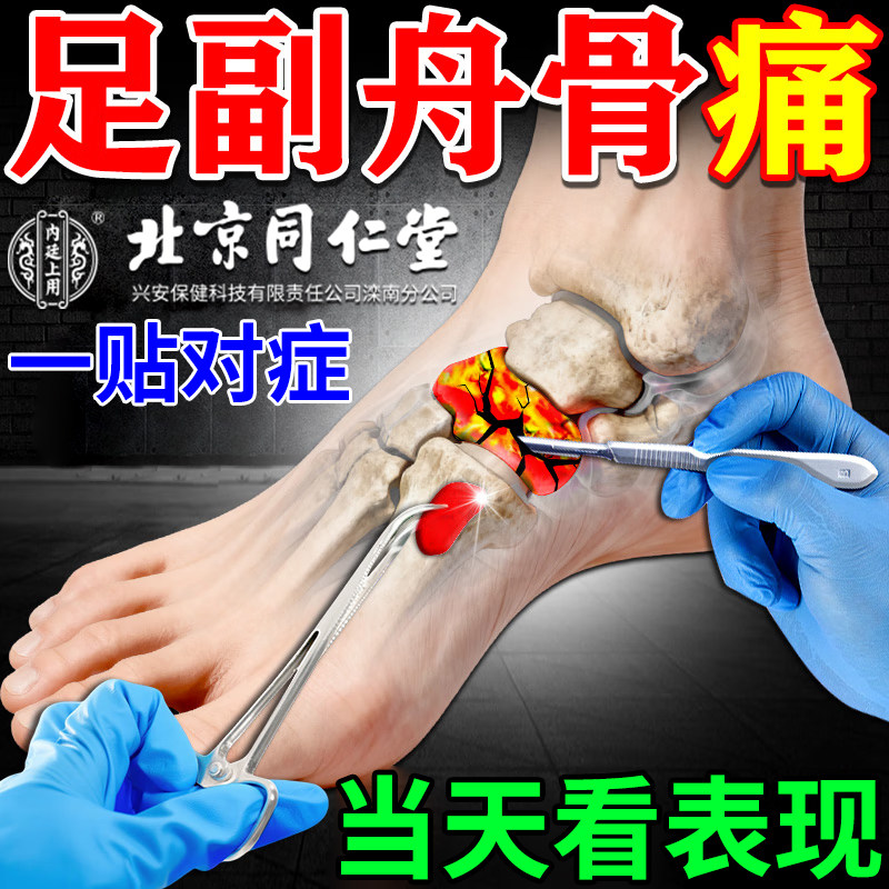 北京同仁堂足副舟骨痛专用膏药贴足跟骨刺脚掌脚后跟疼热敷穴位贴