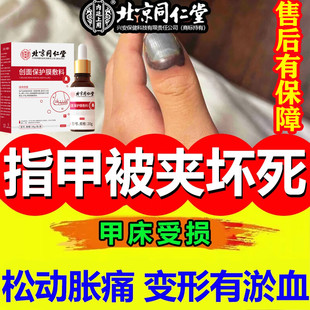怡美堂脚指甲下淤血指甲被压脚趾甲盖夹伤液体敷料手指甲受伤砸伤
