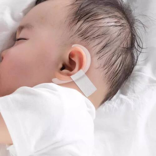 Protruding Ear Support Infant Corrector Tools Silicone Auric