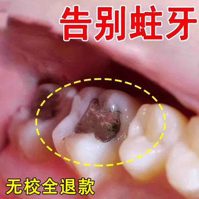 【无校全退】再生硅修复防蛀牙膏