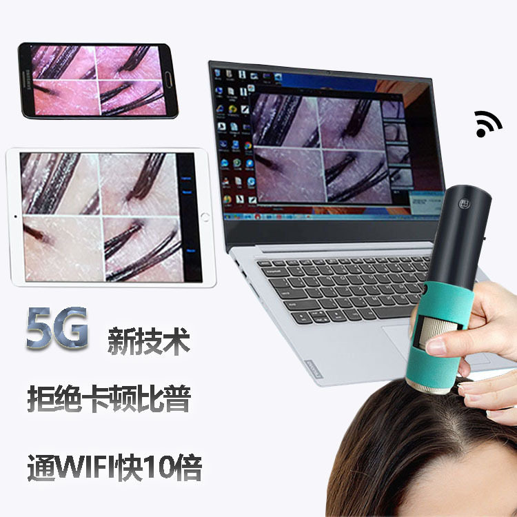 5G无线wifi连手机平板电脑头发检测仪 头皮毛囊毛发检测 智能高清