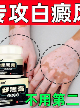 仙怀堂促黑膏白癜风外用药膏汗斑白斑净促黑色素生长修复特效神器