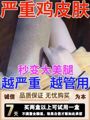 去鸡皮肤身体乳全身嫩白保湿滋润去除疙瘩毛囊角质角化神器鱼鳞皮