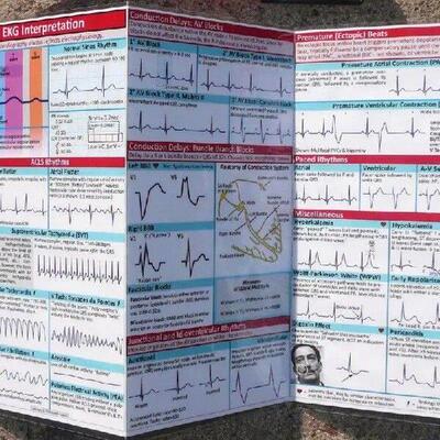 Ekg Rhythm Pocket Cards Ecg Interpretation Pocket Card