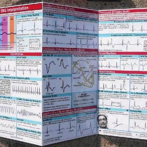 Ekg Rhythm Pocket Cards Ecg Interpretation Pocket Card