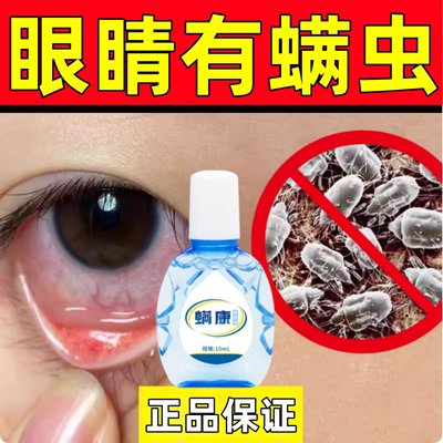 眼睛除螨眼药水眼部干涩红血丝眼皮眼角痒有异物感去螨虫清洁神器