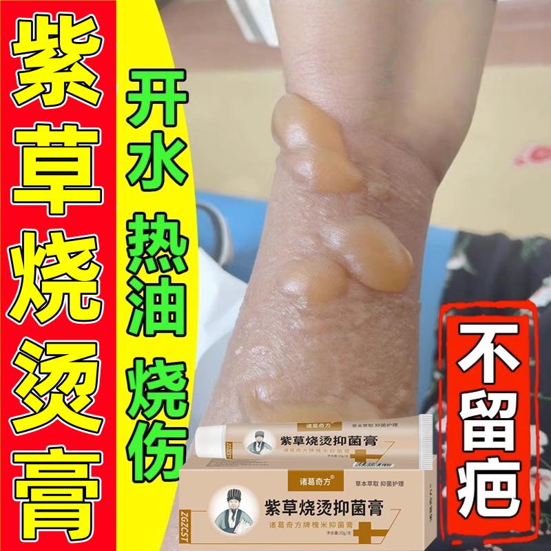 紫草烧烫伤抑菌膏20g皮肤开水高温热油烫伤灼伤温和不刺激护理膏