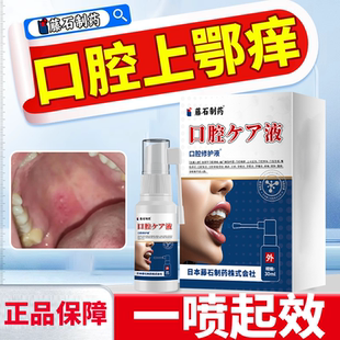 口腔上颚痒干痒肿胀红点不适痛溃疡有异物感喷雾剂药房同款ZR